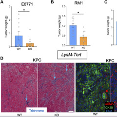How Telomerase Inactivation in Aging Cells Influences Cancer Growth and Metastasis
