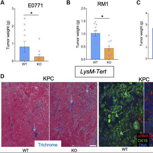 How Telomerase Inactivation in Aging Cells Influences Cancer Growth and Metastasis
