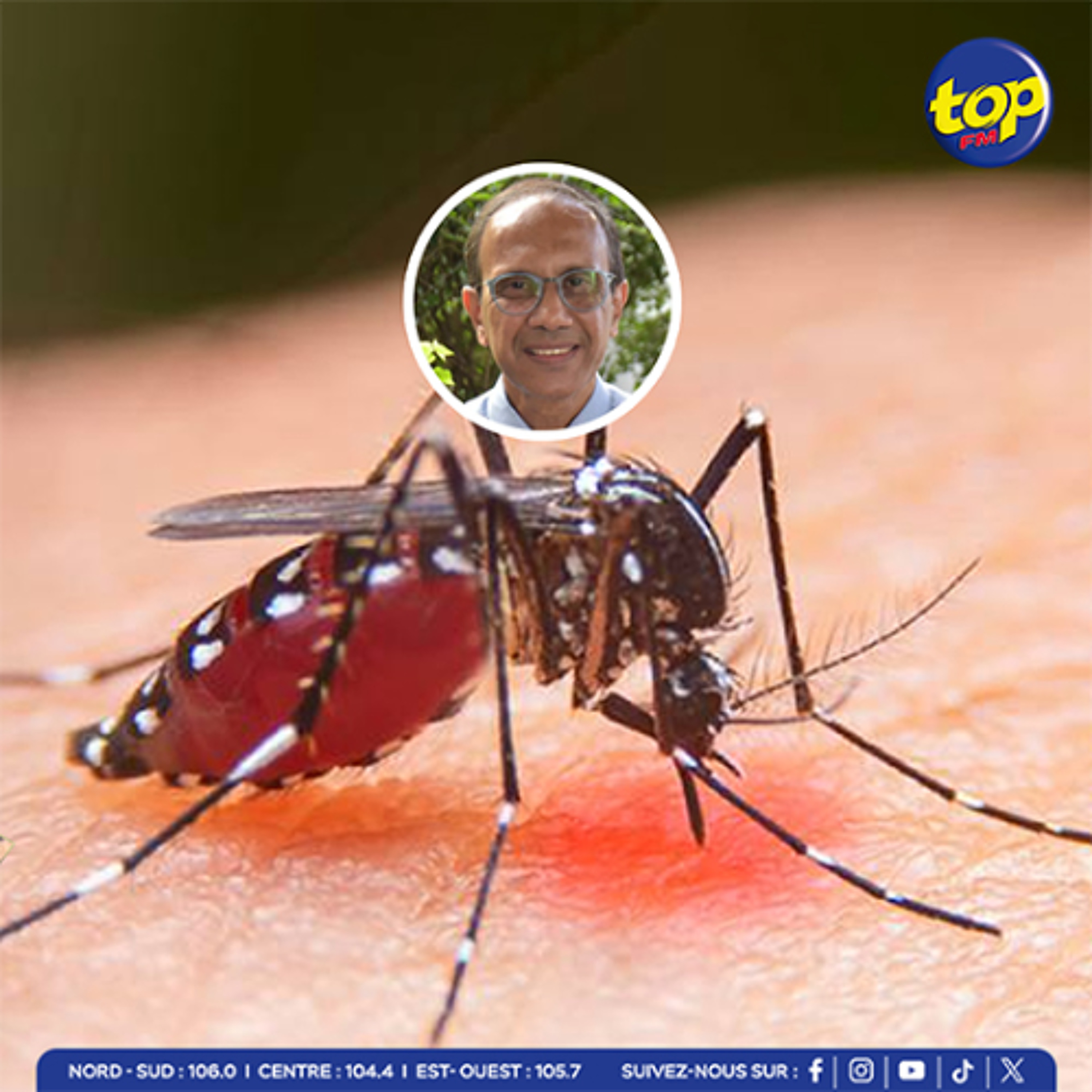 Premier cas de Chikungunya : l’état de santé de la patiente jugée stable