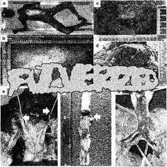 Pulverized - CALLOUS CYSTOMA - demo single