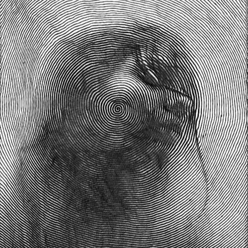 [80] Exposed Wounds