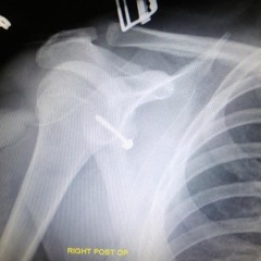 Tech House Mix - Tim Boulie B2B Smokabird