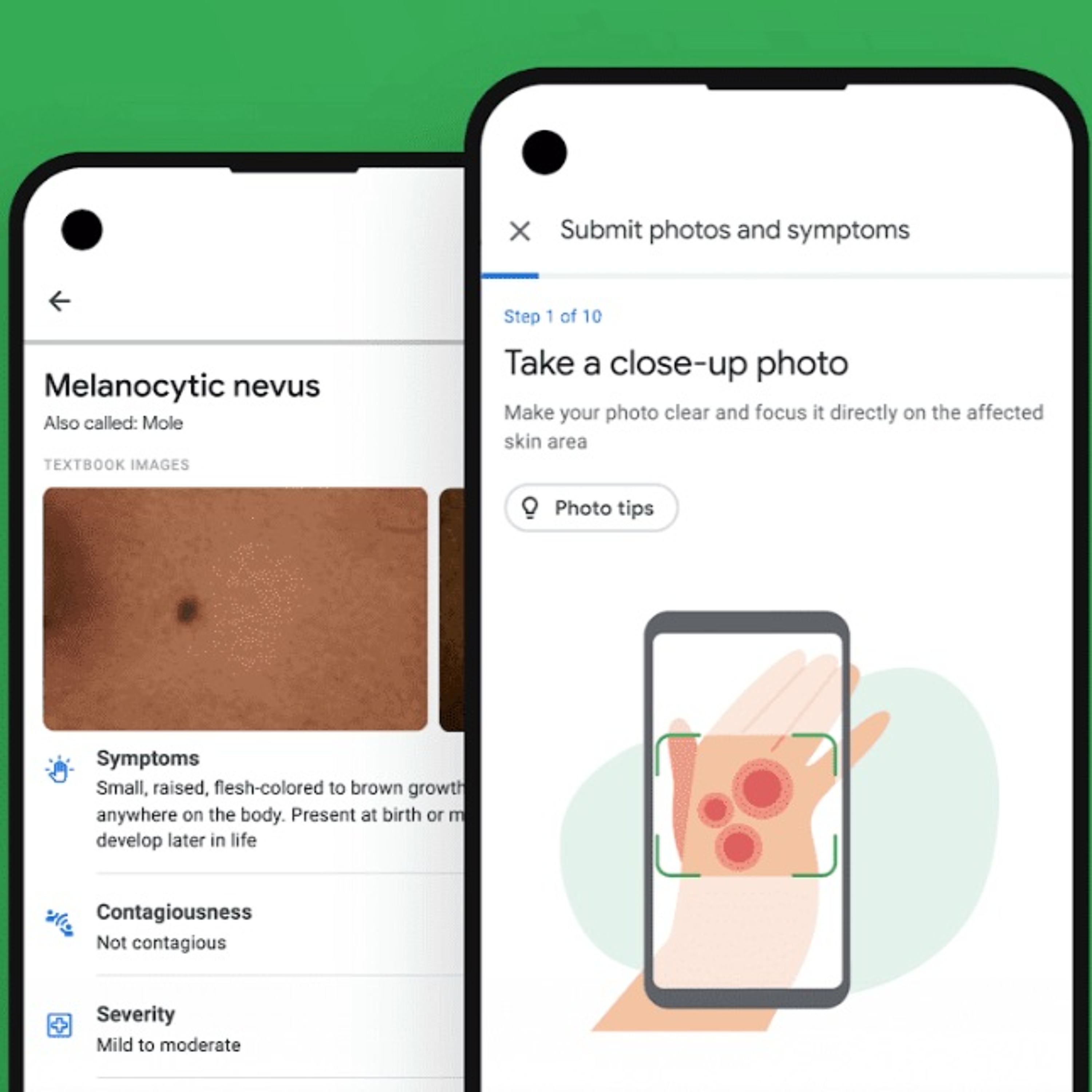 Ask Dr. Google: A health tool identifies skin conditions (20.05.21) episode artwork