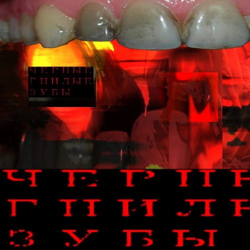 ЧЕРНЫЕ ГНИЛЫЕ ЗУБЫ
