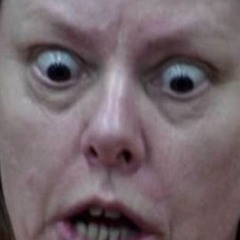 MENTAL.. They never Match on Scracth... watch your fingers you only get mingers the only find inder'