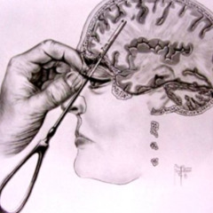 cut ties