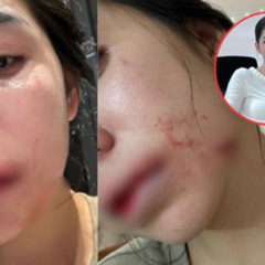 18+ clip hằng du mục clip hằng du mục với tôn bằng clip hằng du mục full