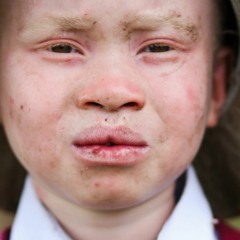 Albinos Prod.Brazer Music