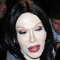 lip injections and botox @tmzwhore