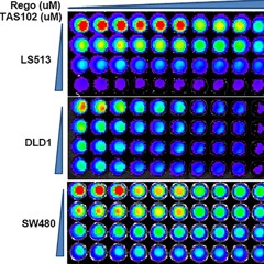 Regorafenib Synergizes With TAS102 Against Multiple Gastrointestinal Cancers