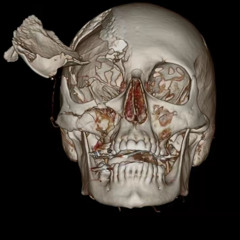 (Emo track 2023) for real emos