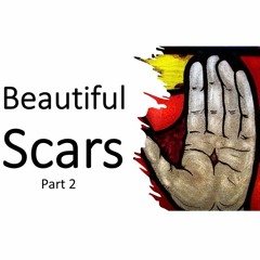 Beautiful Scars, Part 2