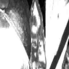 ⁴²emolda x qr! - f#ck my Life
