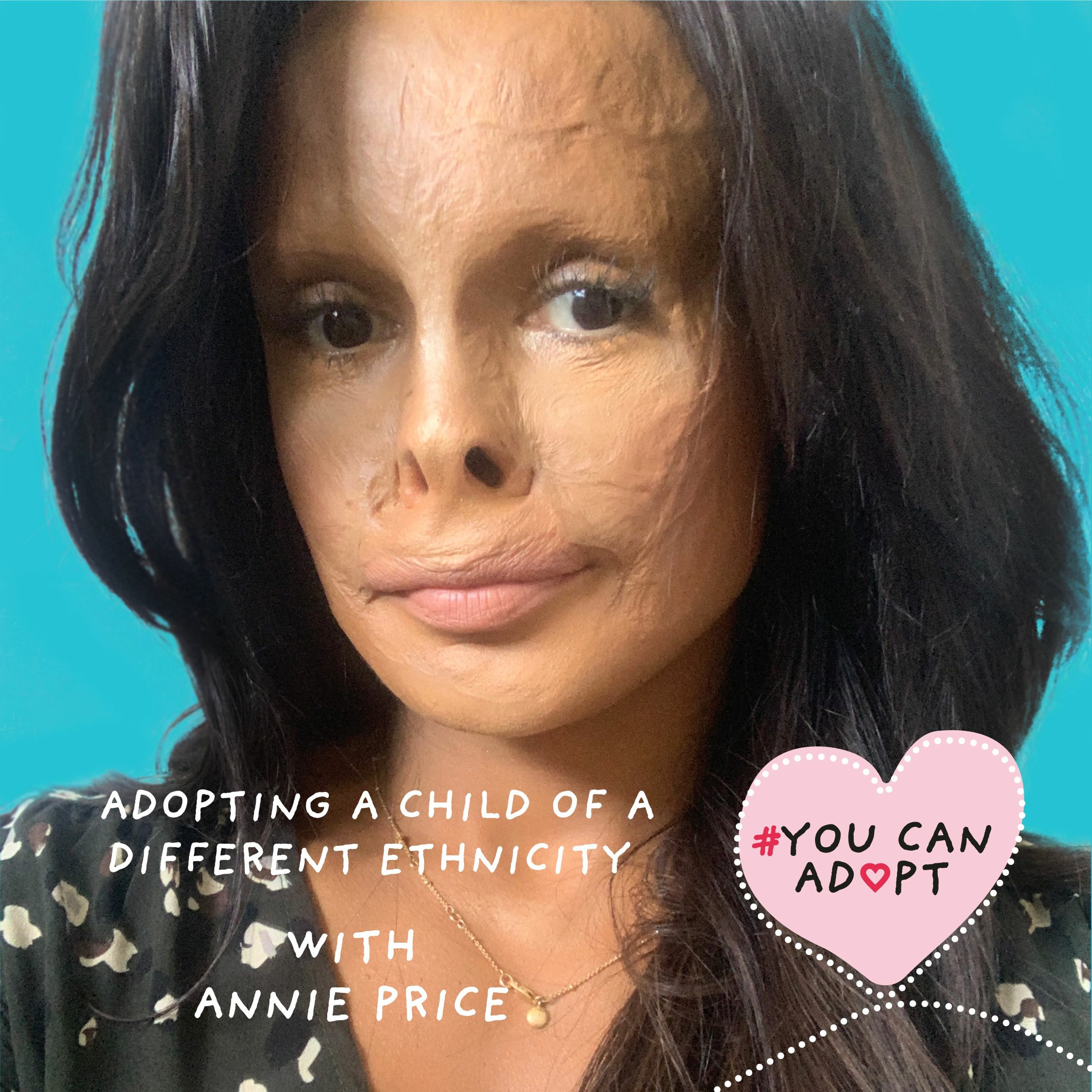 Adopting a Child of a Different Ethnicity with Annie Price episode artwork