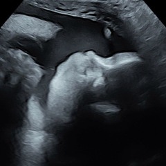 FOREVERSTAYPIST - Samiiis Parade