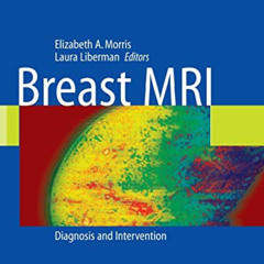 [FREE] PDF 📙 Breast MRI: Diagnosis and Intervention by  Laura Liberman EPUB KINDLE P