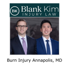 Burn Injury Annapolis, MD