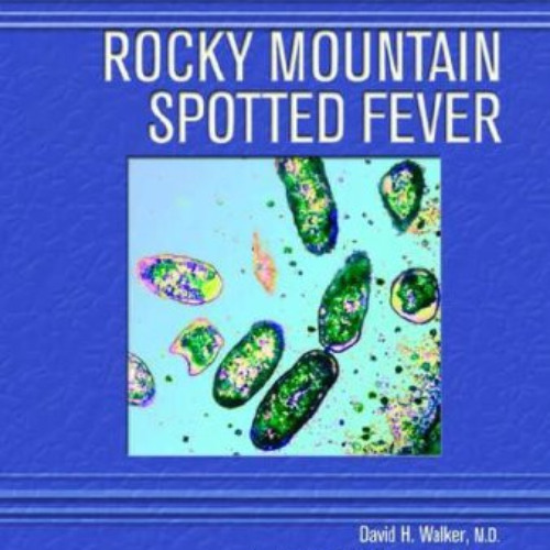 [READ] PDF 💕 Rocky Mountain Spotted Fever (Deadly Diseases & Epidemics (Hardcover))