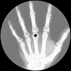 X-RAY