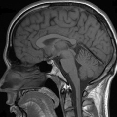 The R Complex