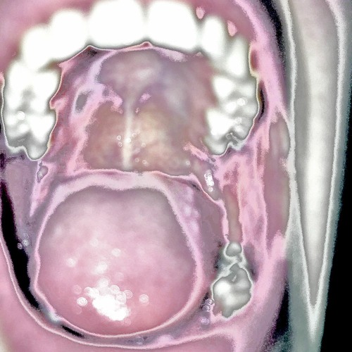 Kalher - Mr. E [FREE DL]