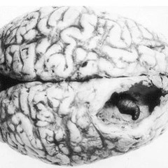 No2 - Mental Reboot // We love tekno //06
