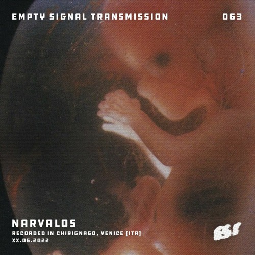 E.S.T. 063 • Narvalos