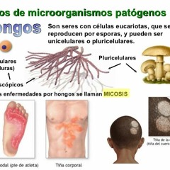 Actividad 2 Infecciones Producidas por hongos