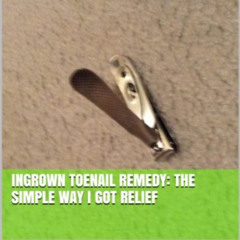 [FREE] EBOOK ✏️ Ingrown Toenail Remedy: The Simple Way I Got Relief by  Tim Carlton [