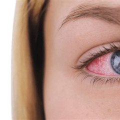 Best Popped Eye Vessel Treatment Reviews