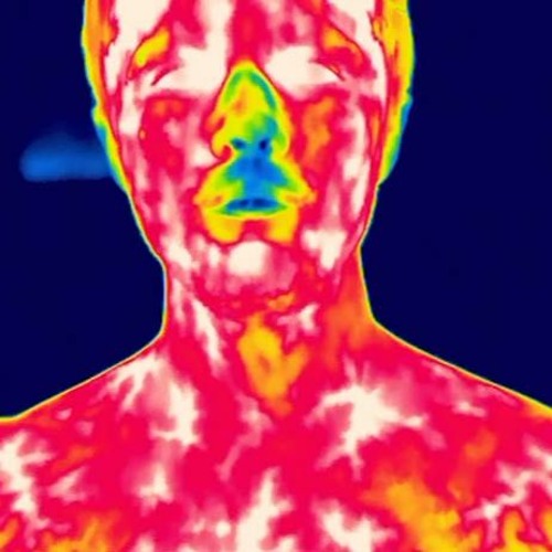 ThermalBurns (1ndulgence)