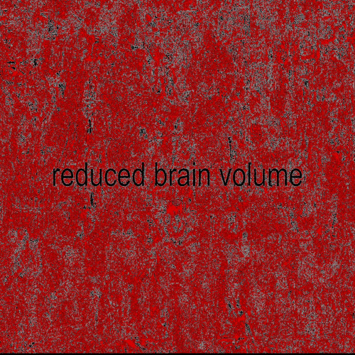 reduced brain volume