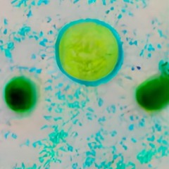 Allan Elder - Rákosfalva