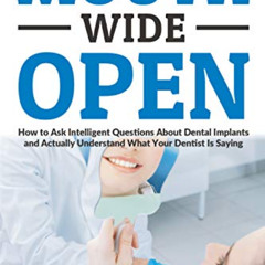 [GET] KINDLE 🖊️ Mouth Wide Open: How To Ask Intelligent Questions About Dental Impla