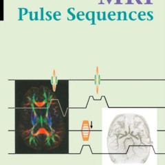 GET EBOOK 📝 Handbook of MRI Pulse Sequences by  Matt A. Bernstein,Kevin F. King,Xiao