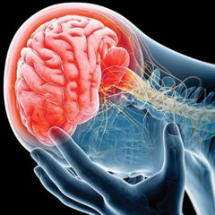 Accidente Cerebro Vascular: Avances en su tratamiento
