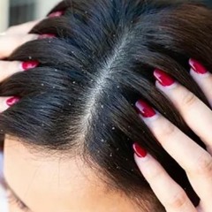 Dandruff Treatment Hair Spa In Chennai
