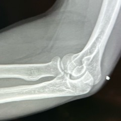Broken Wing V1
