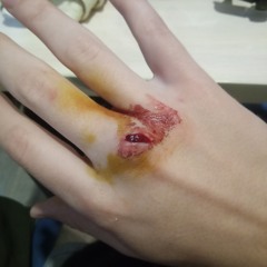 борьба с самим собой