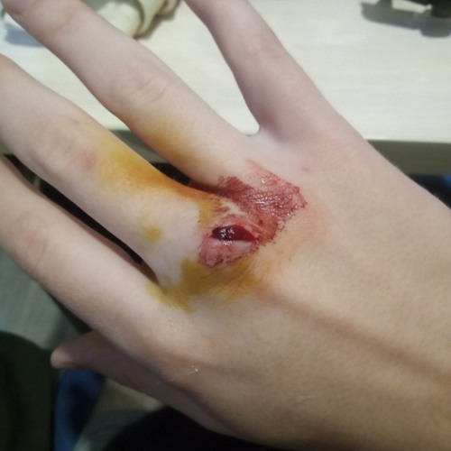 борьба с самим собой