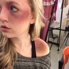 scars! (p. scrlt + xar)