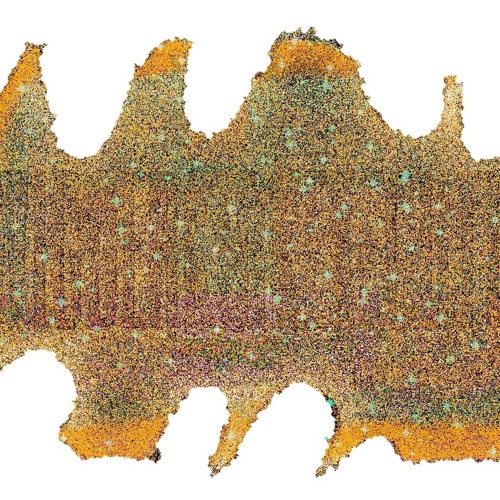 5 headache aids (intro) (NEW ALBUM ON ARCHIVE.ORG)