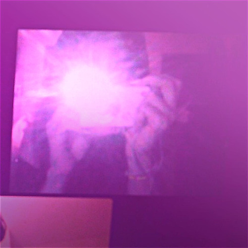 favorite scar (Prod.byCian)