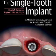 GET KINDLE 💚 The Single-Tooth Implant:: A Minimally Invasive Approach for Anterior a