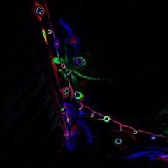 BLIND TO THE SONG (Много дел rmx)