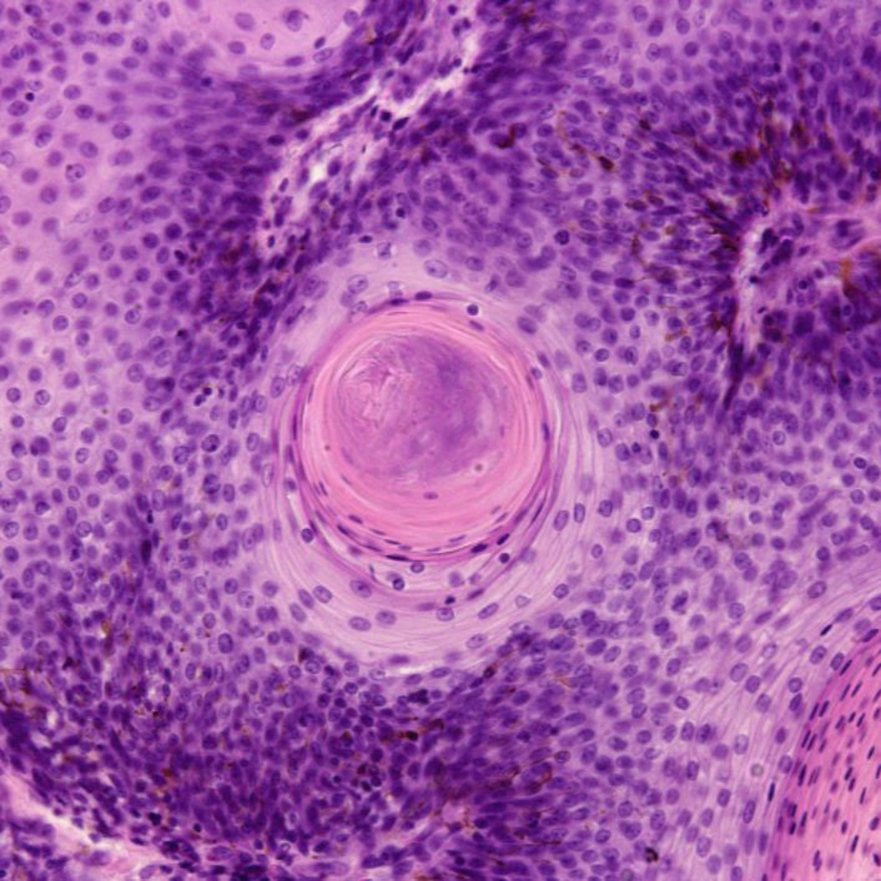 Oncotarget
