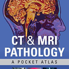 Read EBOOK 🗃️ CT & MRI Pathology: A Pocket Atlas, Third Edition by  Michael L. Grey