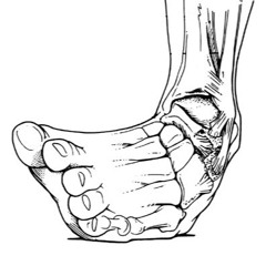 ankles