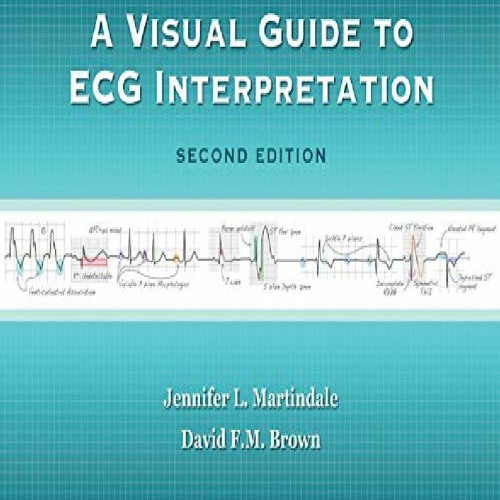 Stream episode [DOWNLOAD PDF] A Visual Guide to ECG Interpretation ipad ...