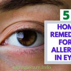 Best Eye Allergy Treatment Home Remedies Reviews